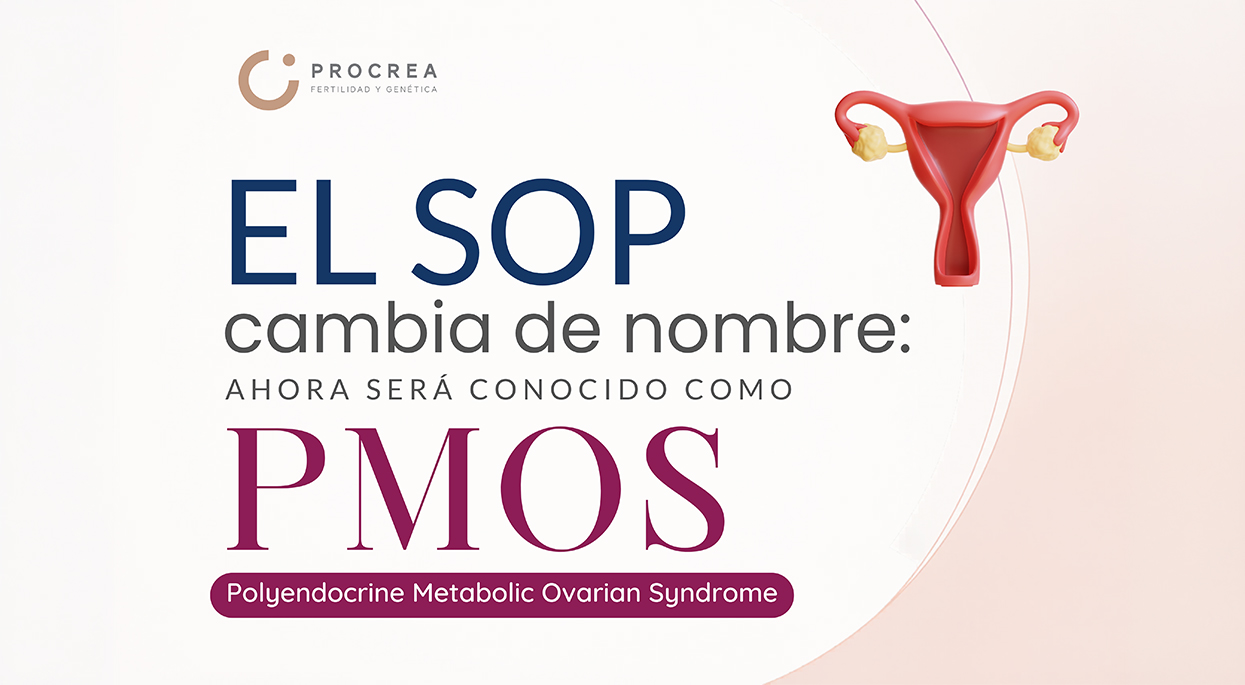 El SOP cambia de nombre: ahora será conocido como PMOS